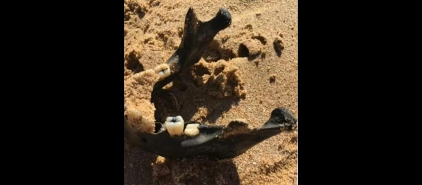 Φρίκη: Βρήκε ένα ανθρώπινο σαγόνι στην παραλία! (βίντεο)